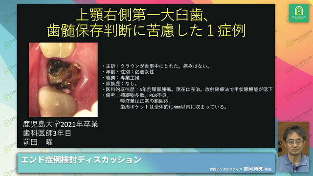 Endo Case Discussion NEXT - 若手ドクター×エンド専門医 症例 Endo Case Discussion NEXT - 若手ドクター×エンド専門医 症例