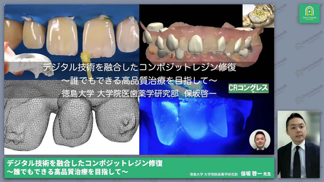 デジタル技術を融合したコンポジットレジン修復〜誰でもできる高 デジタル技術を融合したコンポジットレジン修復〜誰でもできる高