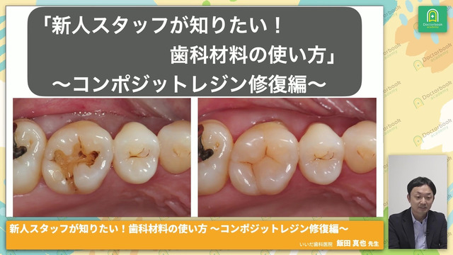 新人スタッフが知りたい!歯科材料の使い方 コンポジットレジン 新人スタッフが知りたい!歯科材料の使い方 コンポジットレジン