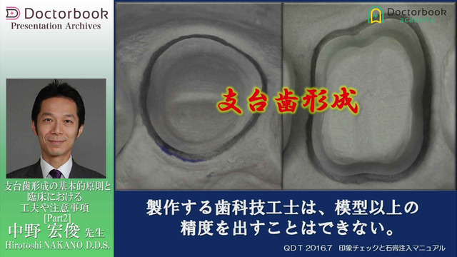 支台歯形成の基本的原則と臨床における工夫や注意事項 支台歯形成の基本的原則と臨床における工夫や注意事項
