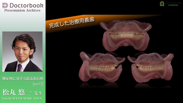 難症例に対する総義歯治療 | Doctorbook academy (ドクター 難症例に対する総義歯治療 | Doctorbook academy (ドクター