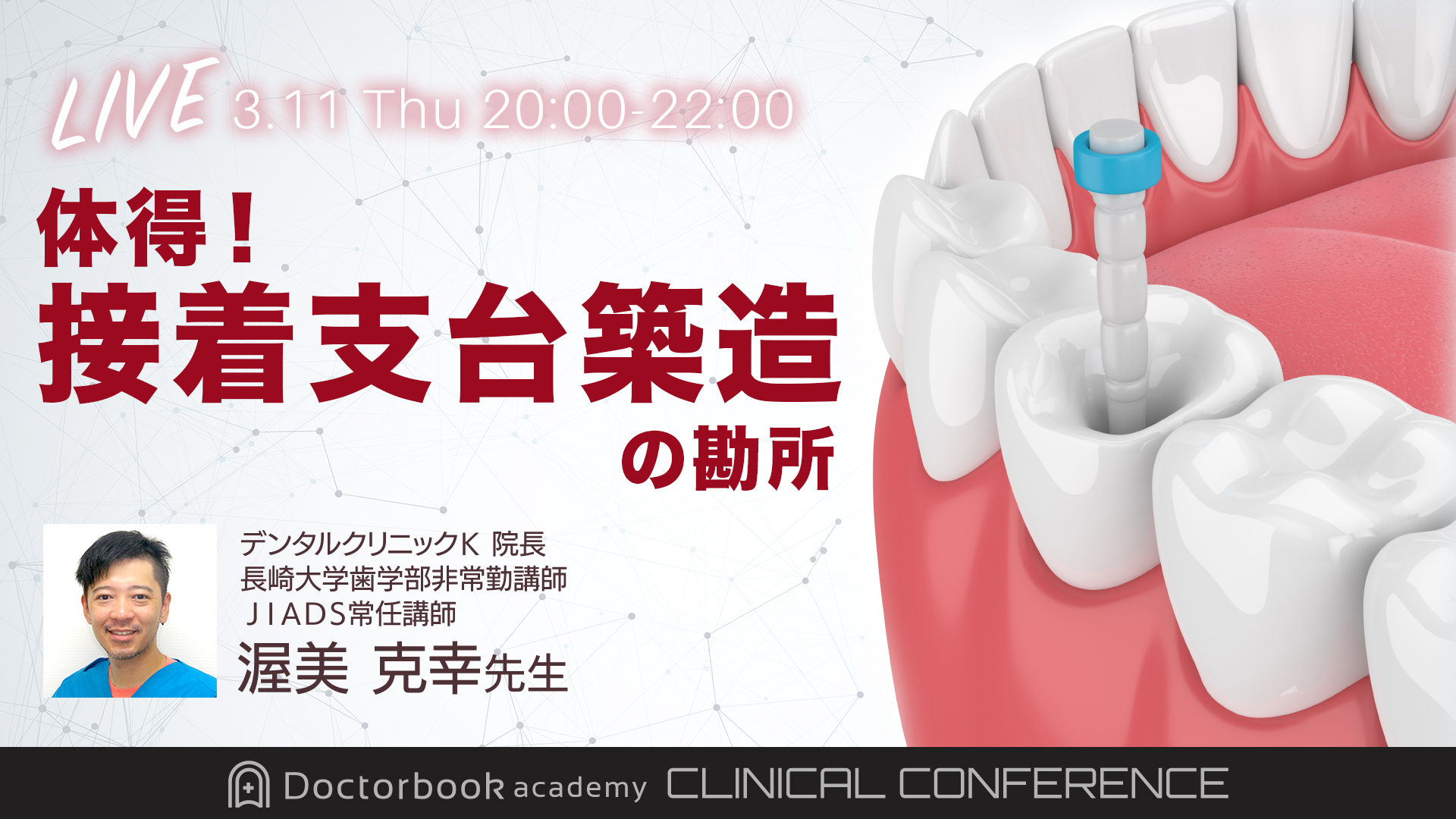 【LIVE】 実習参加型セミナー「体得！接着支台築造の勘所」渥美克幸先生　クリニカル・カンファレンス