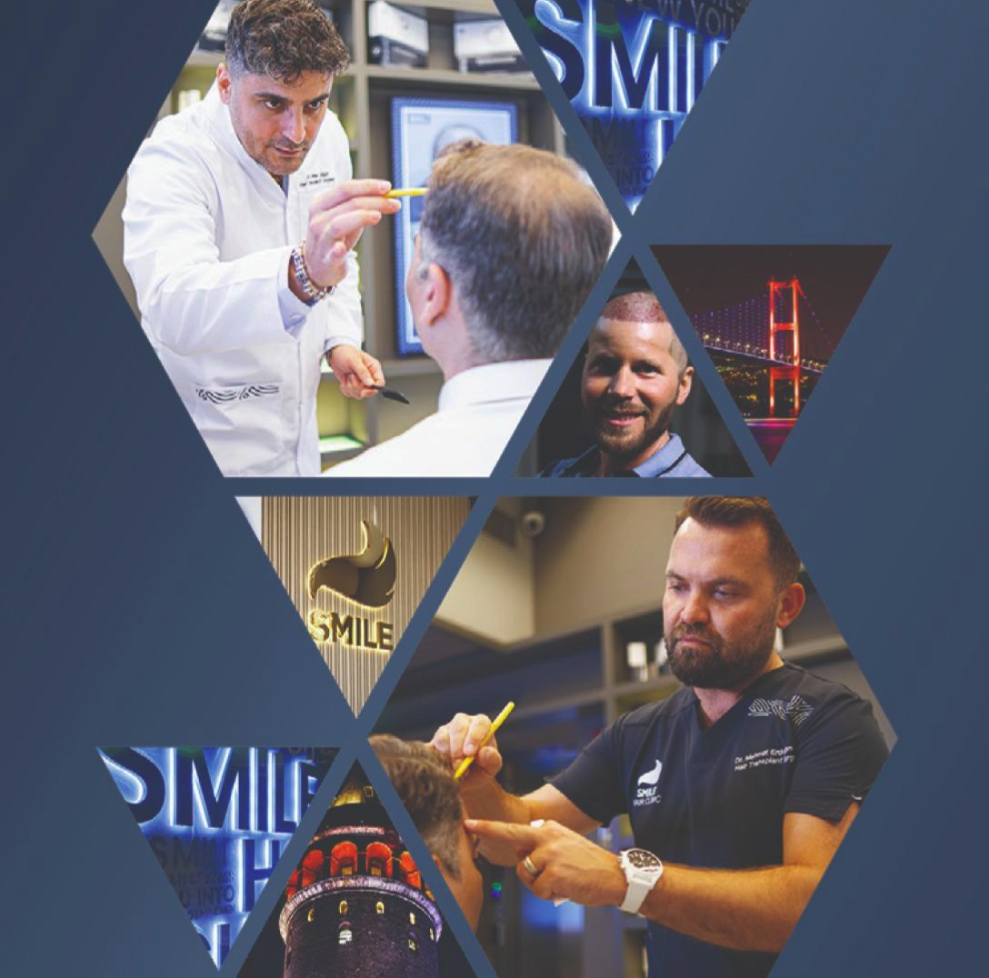 Hair Transplant Turkey: Learn about the Quality of Smile Hair Clinic