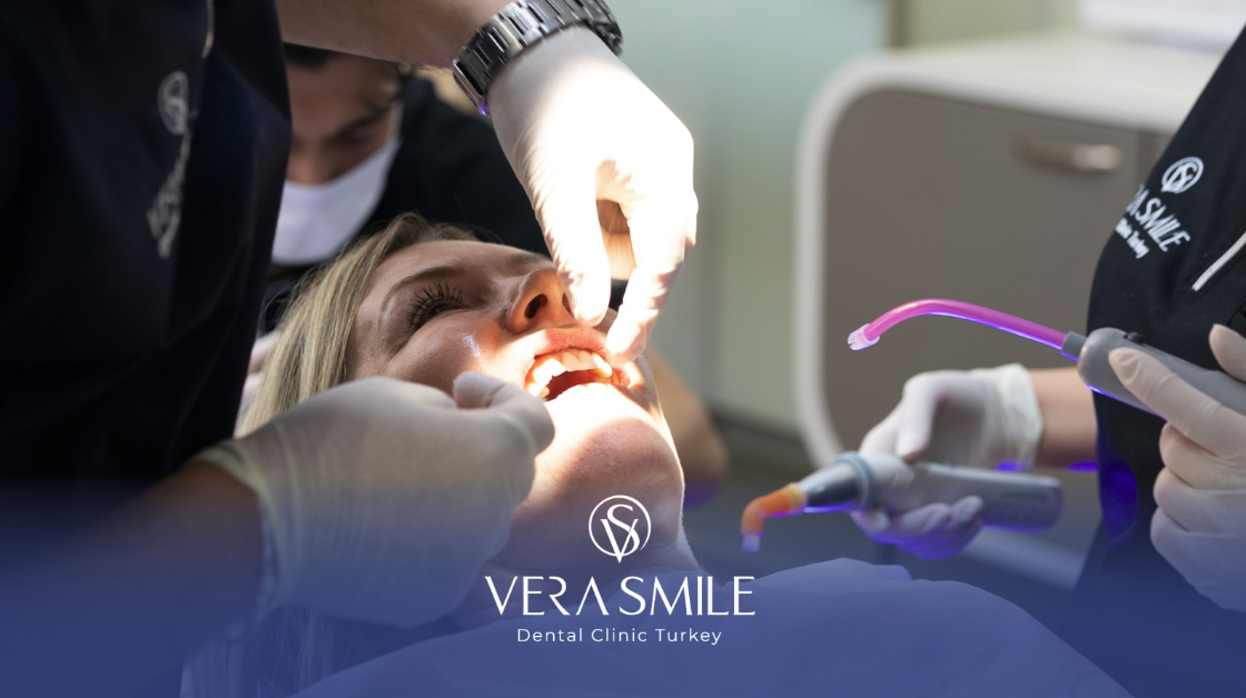 Dental Materials and Implant Systems in Istanbul: What Patients Should Know (2025) 