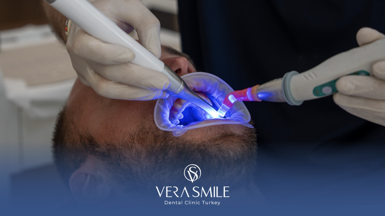 Full-Mouth Dental Implants and Smile Makeovers in Istanbul: What You Need to Know (2025) 