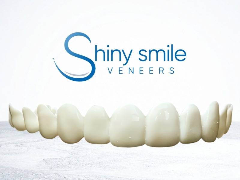 Shiny Smile Veneers Consumer Guide Examines Cost, Process, and Cosmetic Fit Considerations