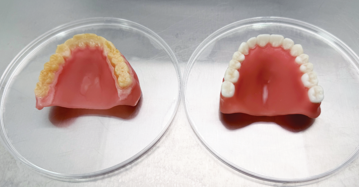 Glidewell Presents Study on Antimicrobial 3D-Printed Dentures at Antibiotics 2026 Conference in Barcelona