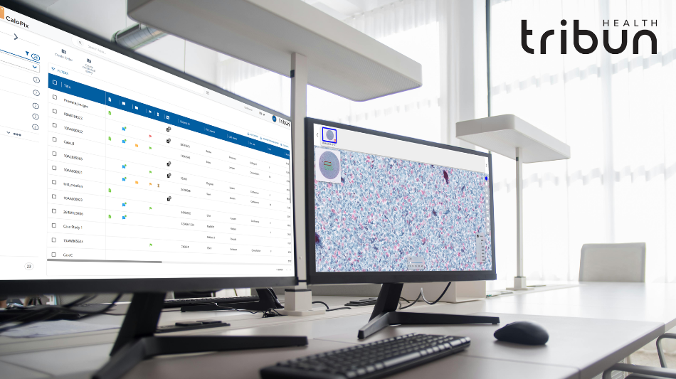 Tribun Health Supports CGI's Vendor of Record Selection Across All Four Mohawk Medbuy Digital Pathology Software Categories 