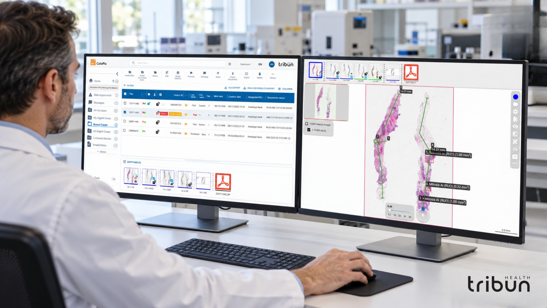 Tribun Health Expands into Australia as CaloPix(R) 6.2.0 Is Included in the ARTG