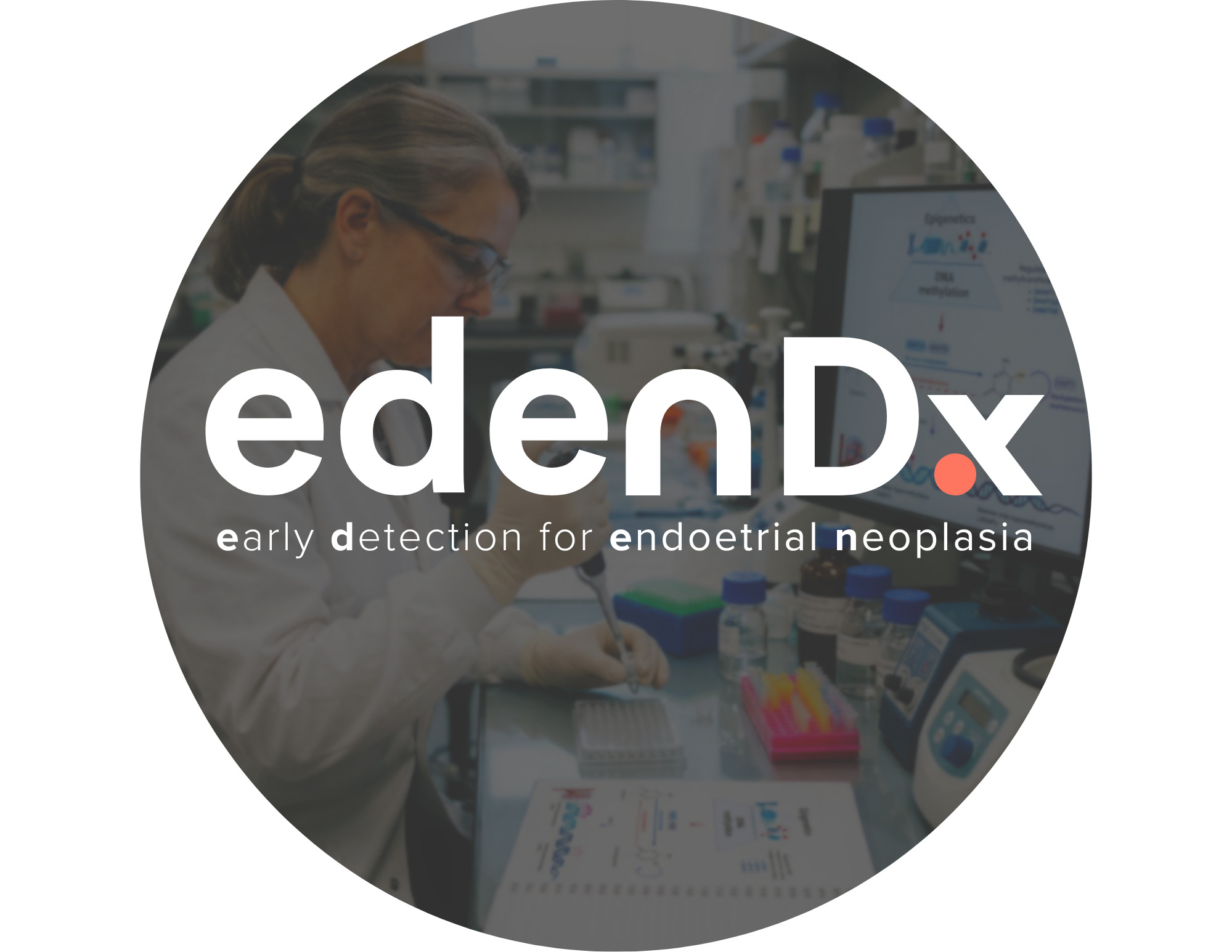 EdenDx Assay Validated as Supportive Endometrial Cancer Triage Tool in Peer-Reviewed Study