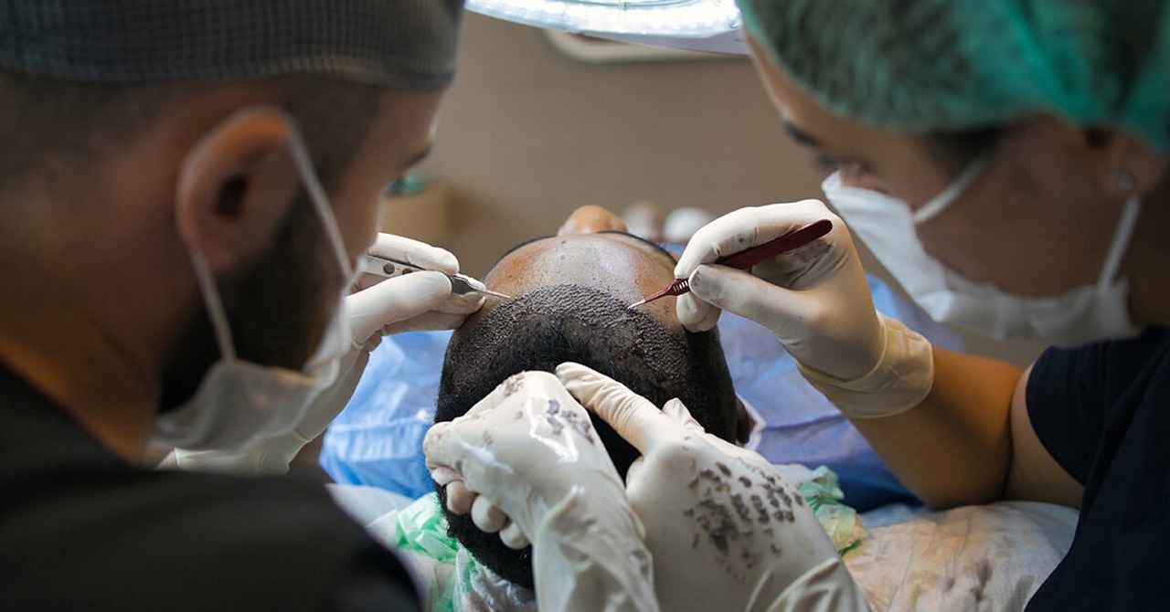 Hair Transplant Review Releases Their Top Chicago Rankings for 2024 