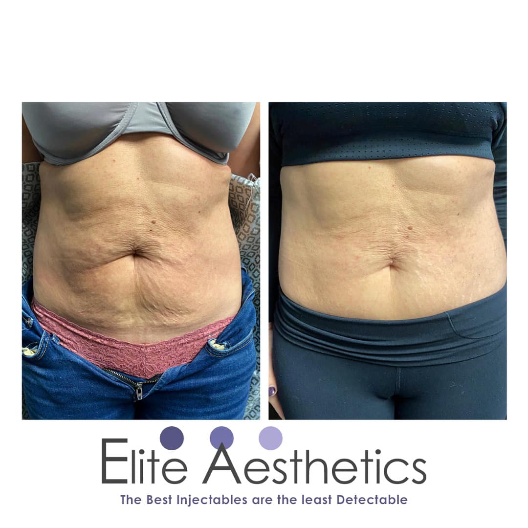 Can a NP own a med spa California?