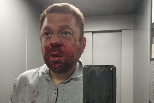 В Югорске избили независимого журналиста Антона Пантина