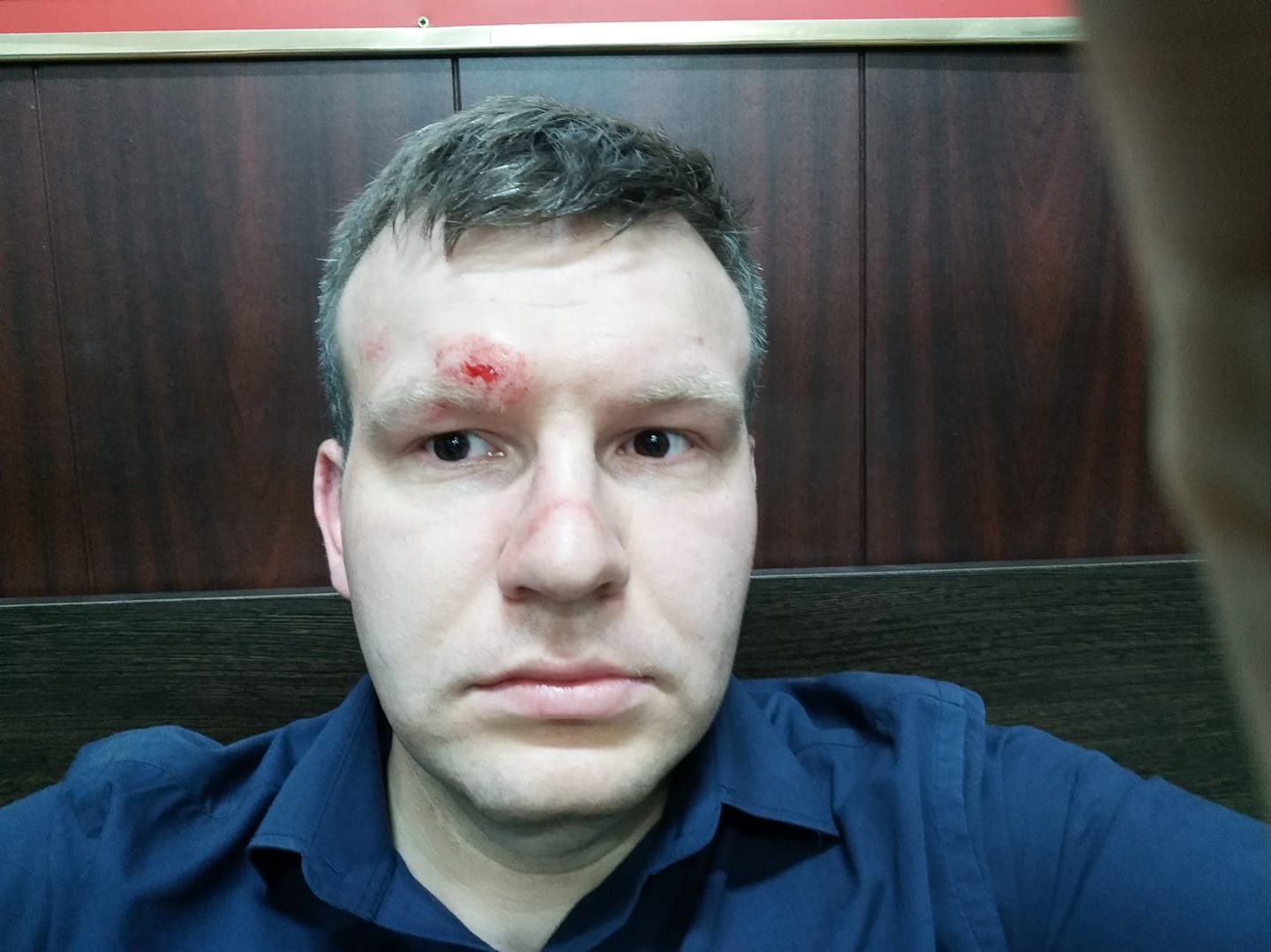 В центре Москвы на активиста набросились несколько человек
