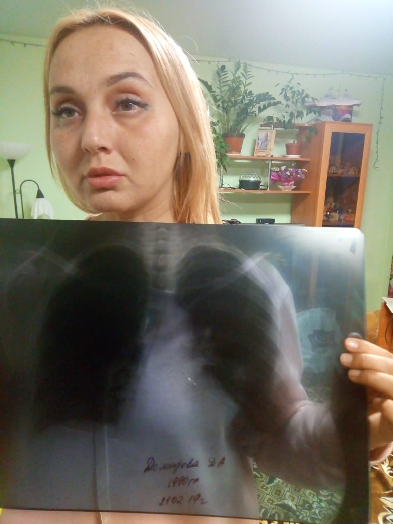 Активистку из Сибая увезли в больницу с отеком лёгких