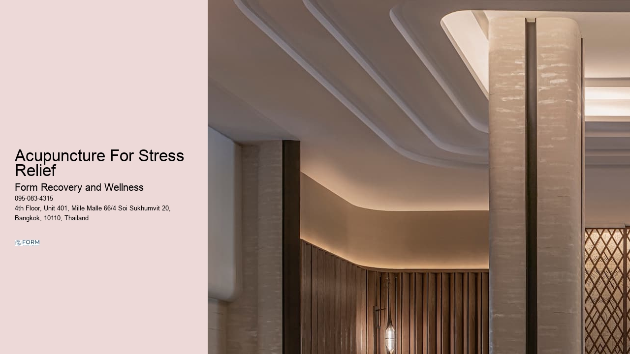 Acupuncture For Stress Relief