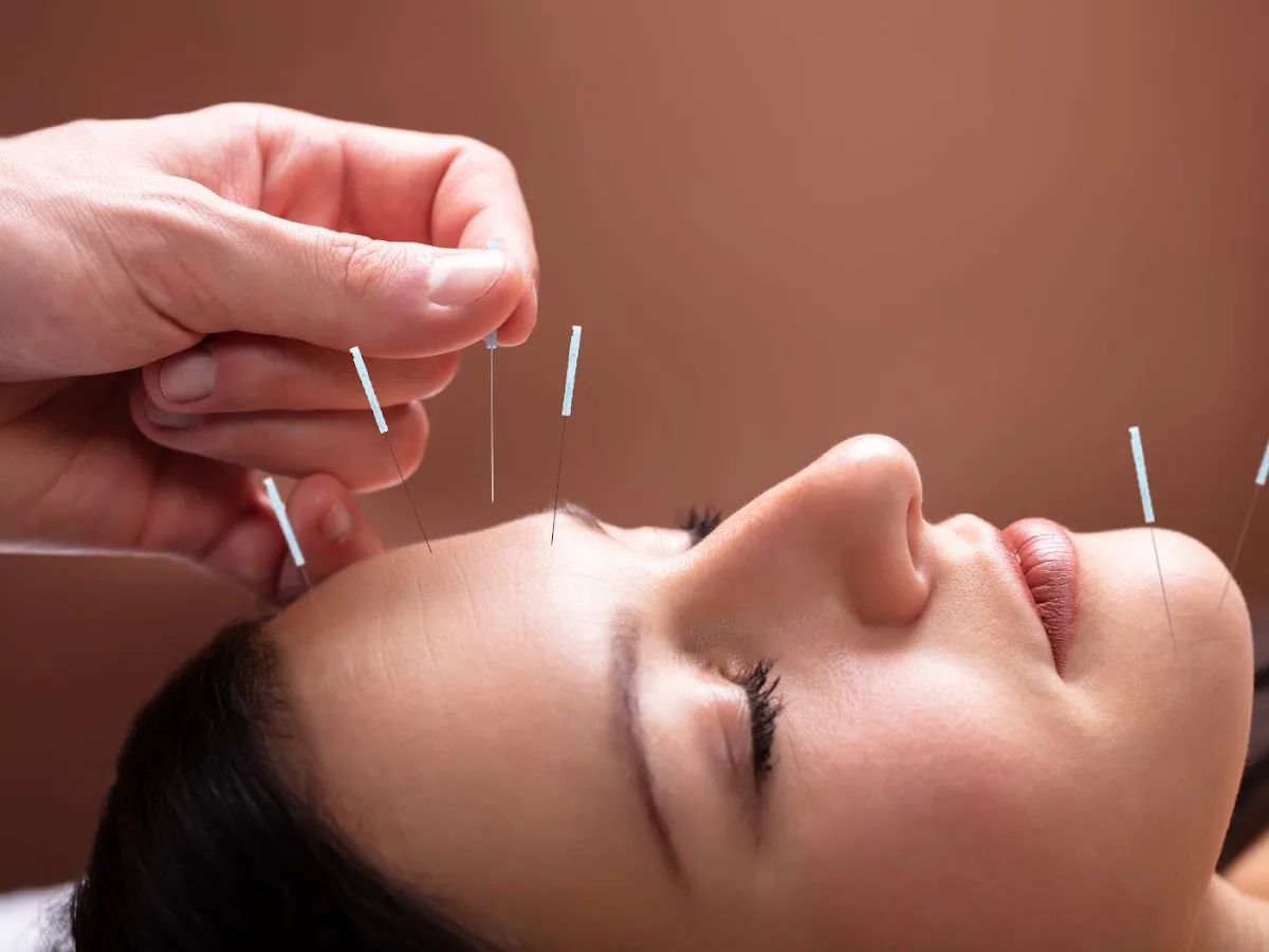 Deare Acupuncture Clinic - John Deare