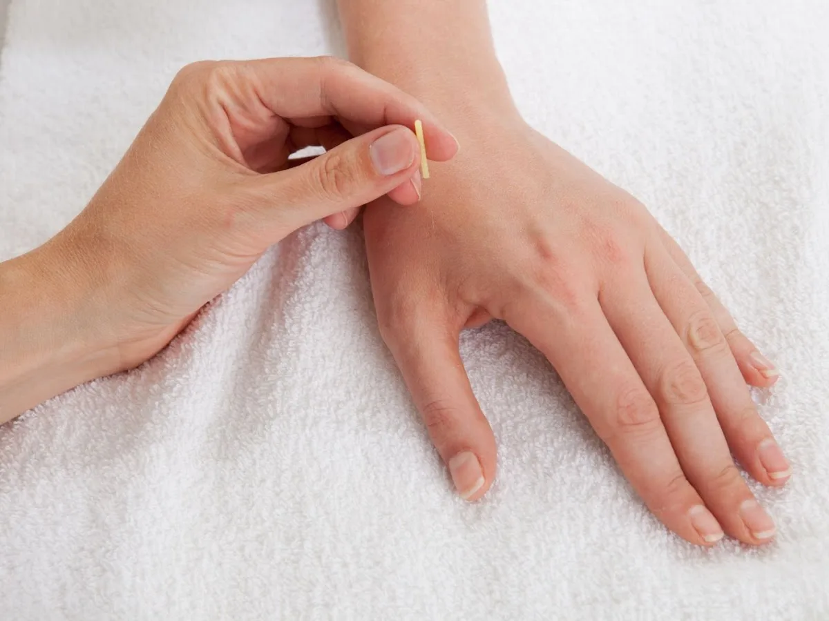 Deare Acupuncture Clinic - John Deare - Photo 4