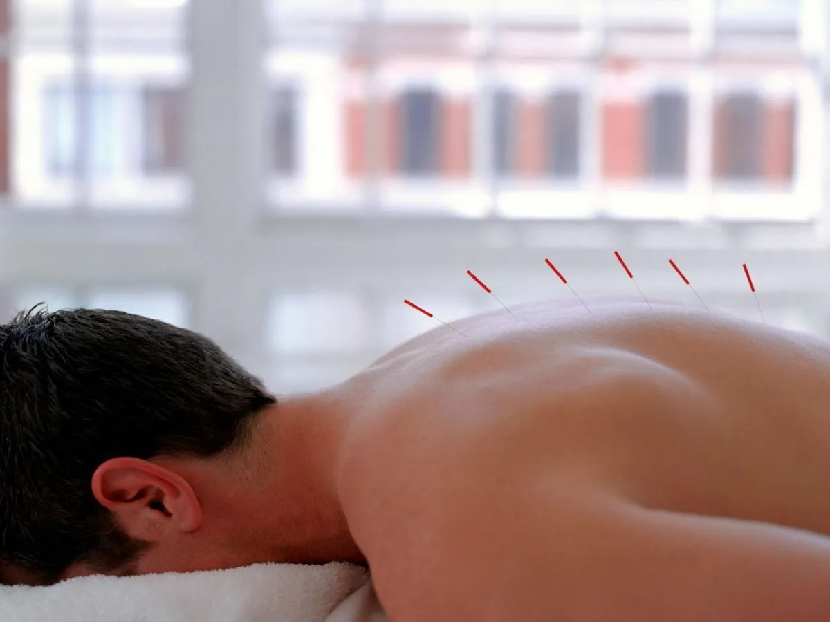 Deare Acupuncture Clinic - John Deare - Photo 5