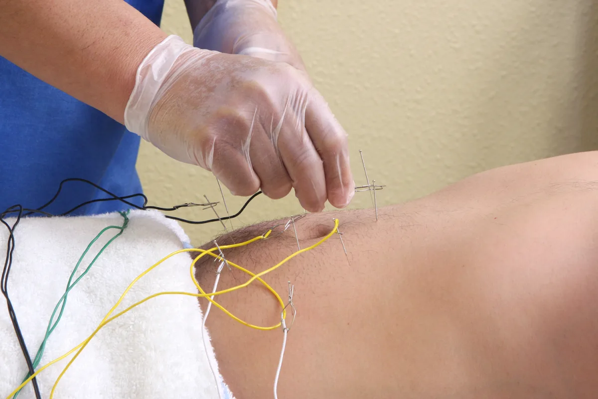 City Acupuncture Pain Clinic - Photo 3