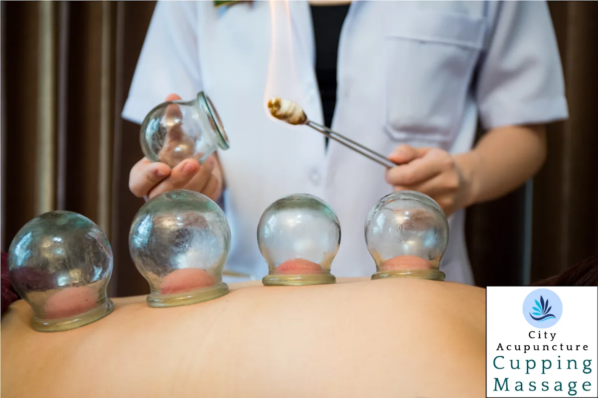 City Acupuncture Pain Clinic - Photo 4