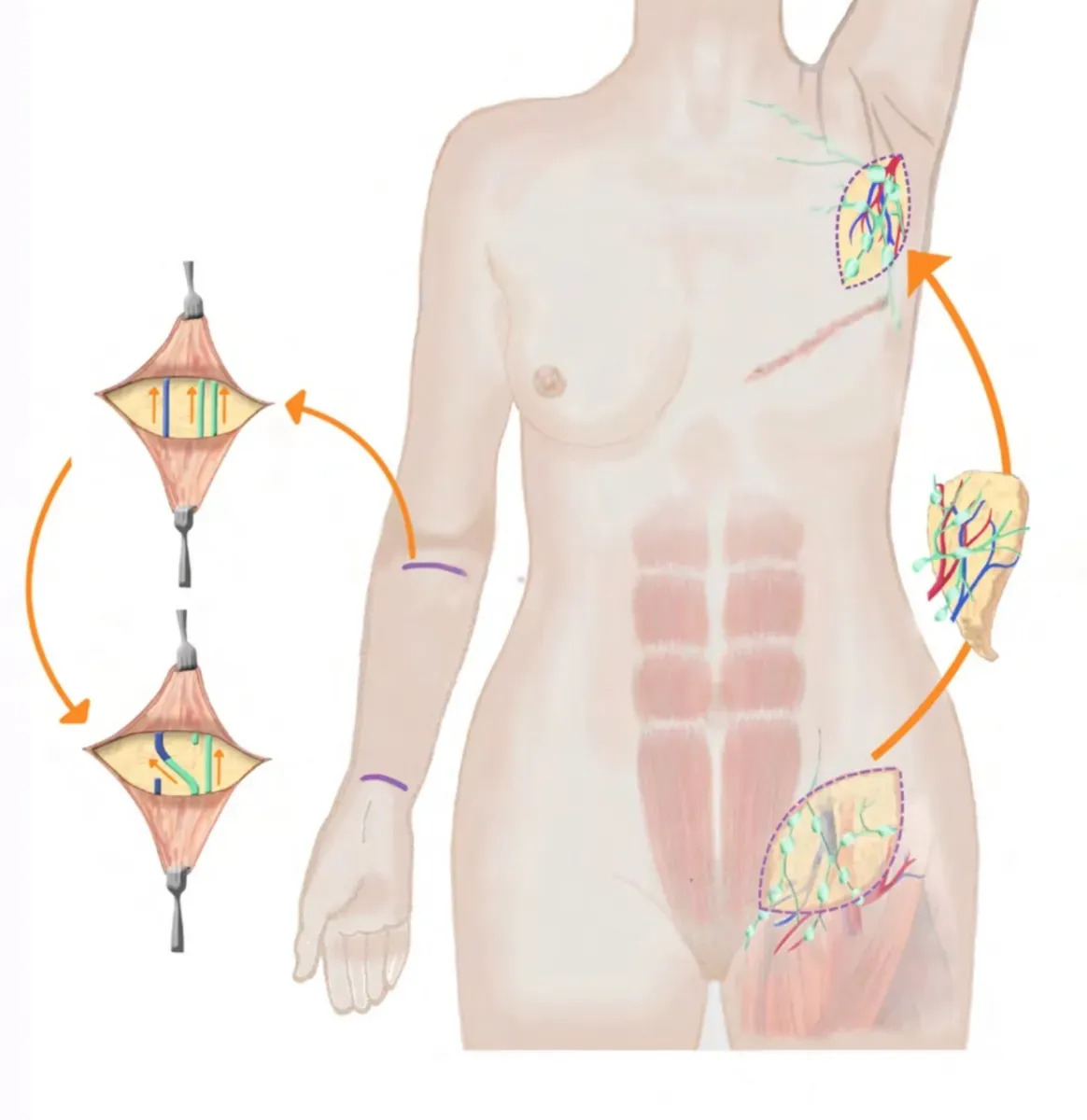 Representation of the lymphatic system