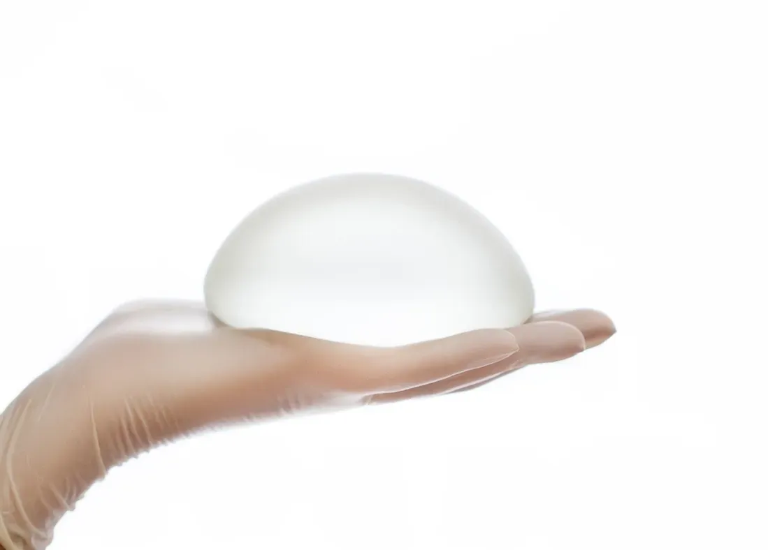 Persona che tiene una protesi mammaria in mano