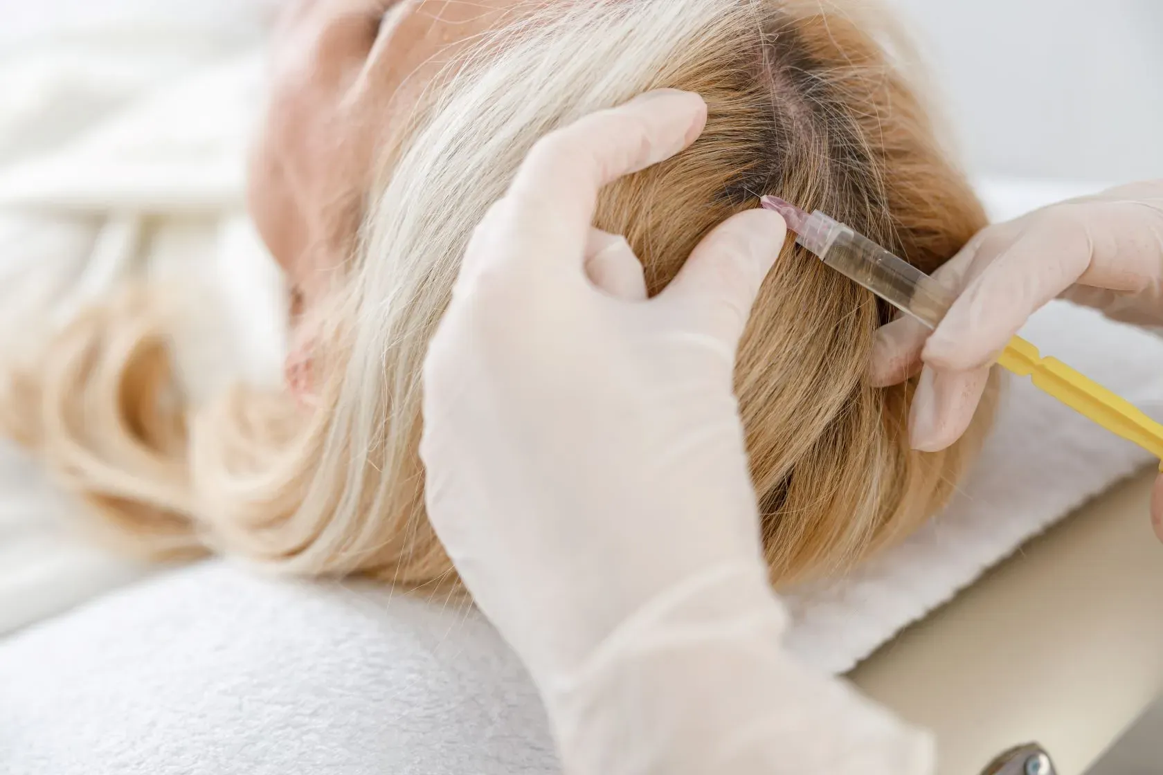 Woman is getting PRP injected into her scalp