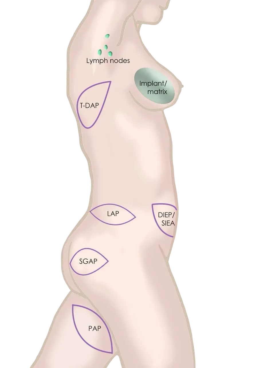 Presentation of breast surgery  