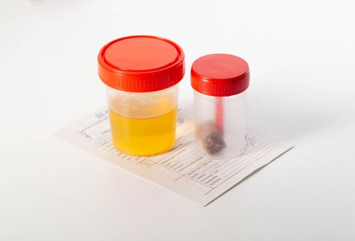 Calprotectin test