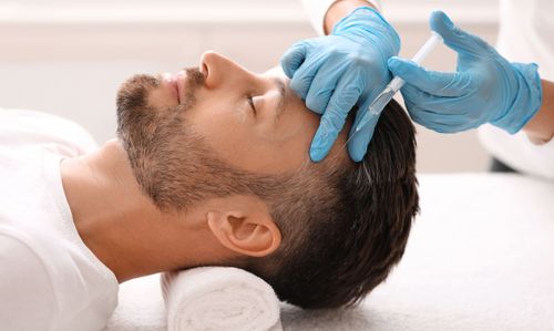 Mesoterapia capilar
