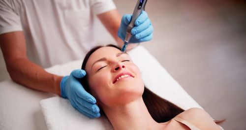 Microneedling