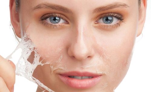 Peeling Facial