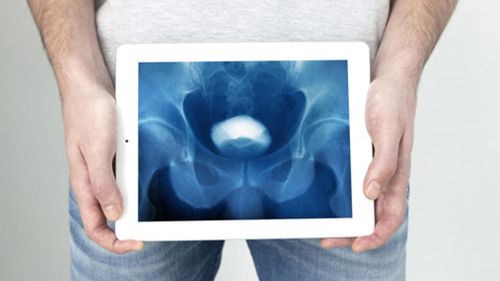 Urografía 