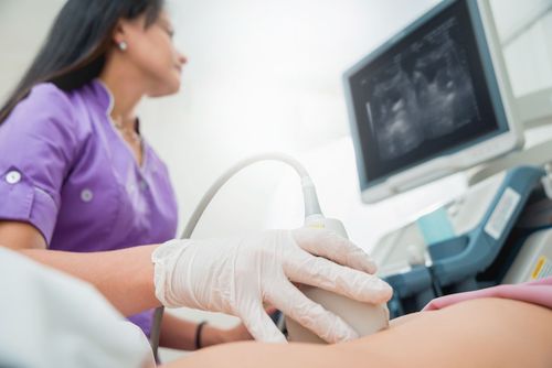 Medical professional performing an ultrasound scan using a Triplex device