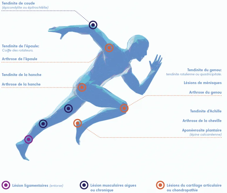 2022.06.14 Plättchenreiches Plasma 2.webp
