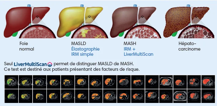 Capture d’écran 2025-07-08 111800.webp