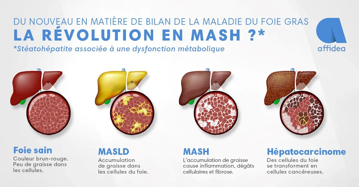 image affidea perspectum_final.webp