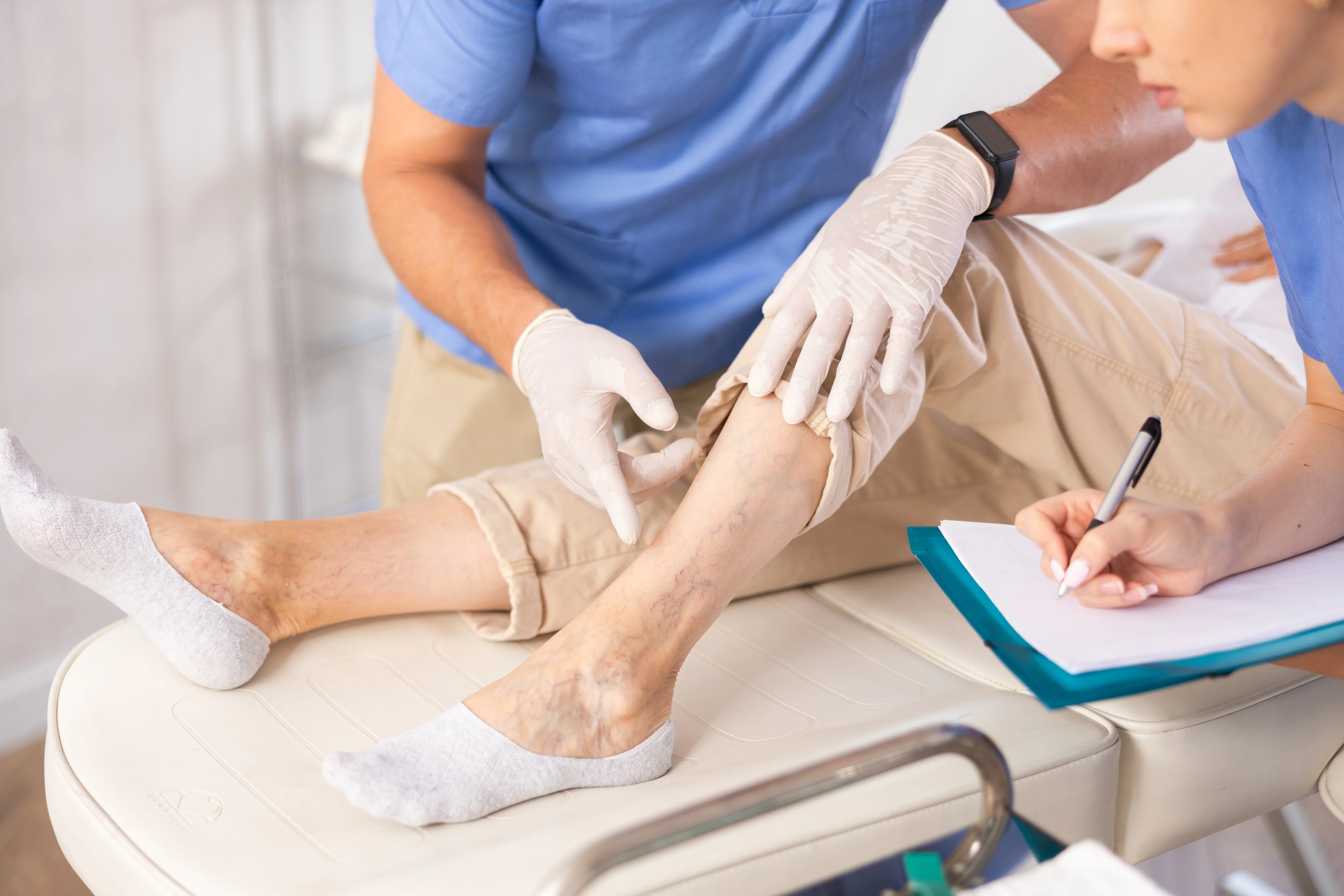 Tratamiento médico de varices en piernas con fleboestética
