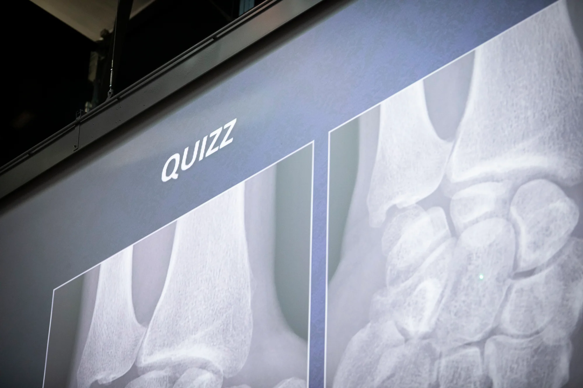 Séminaire Résonance 2023