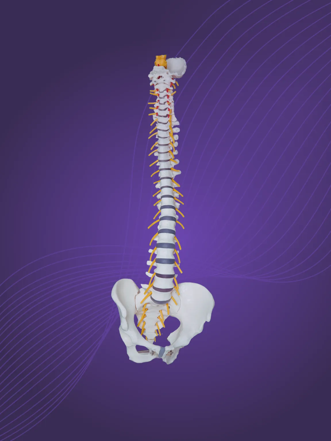 What Causes Whiplash?
