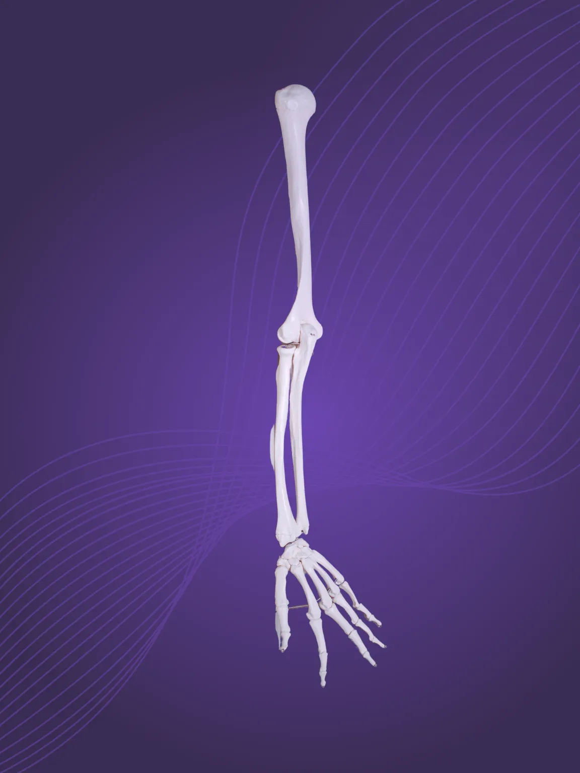 What is elbow instability?