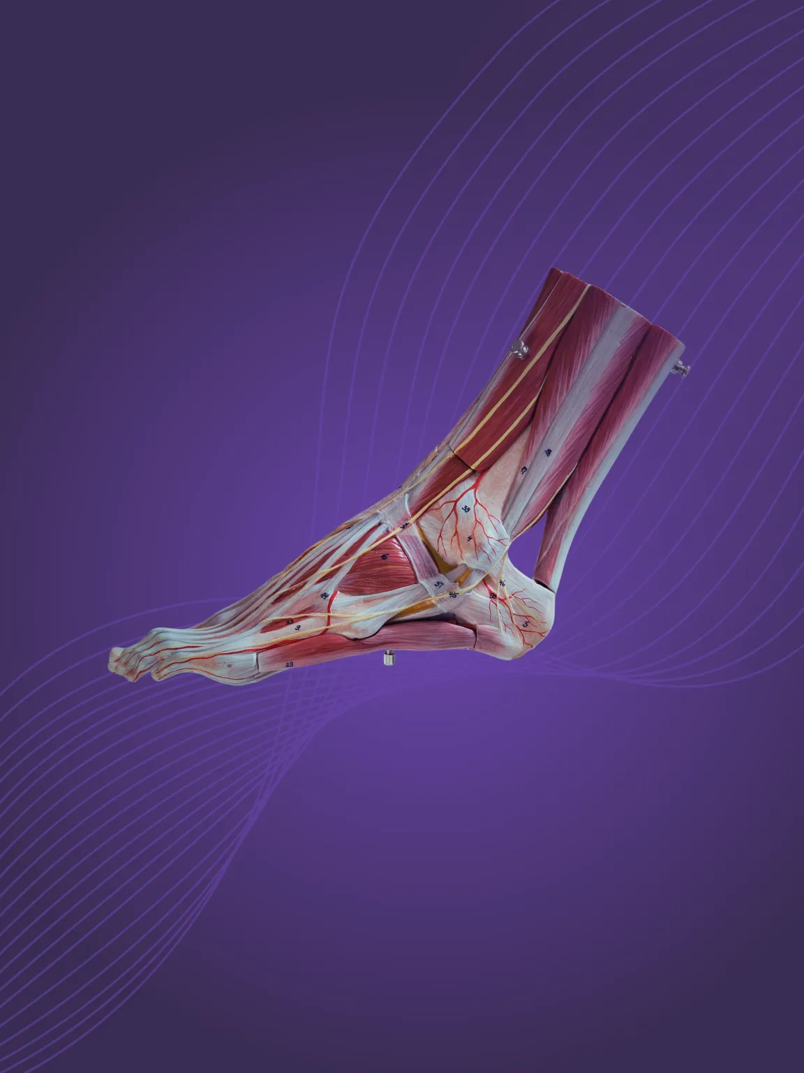 Bunion surgery overview