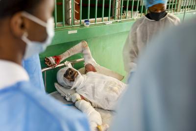 Una persona que sufrió quemaduras cuando un camión de gasolina volcó y explotó yace en una cama en el Hospital Universitario de Justinien, en Cap-Haitien, Haití, el martes 14 de diciembre de 2021. La explosión envolvió en llamas autos y viviendas, mató a más de 50 personas y dejó decenas de heridos. (AP Foto/Odelyn Joseph)