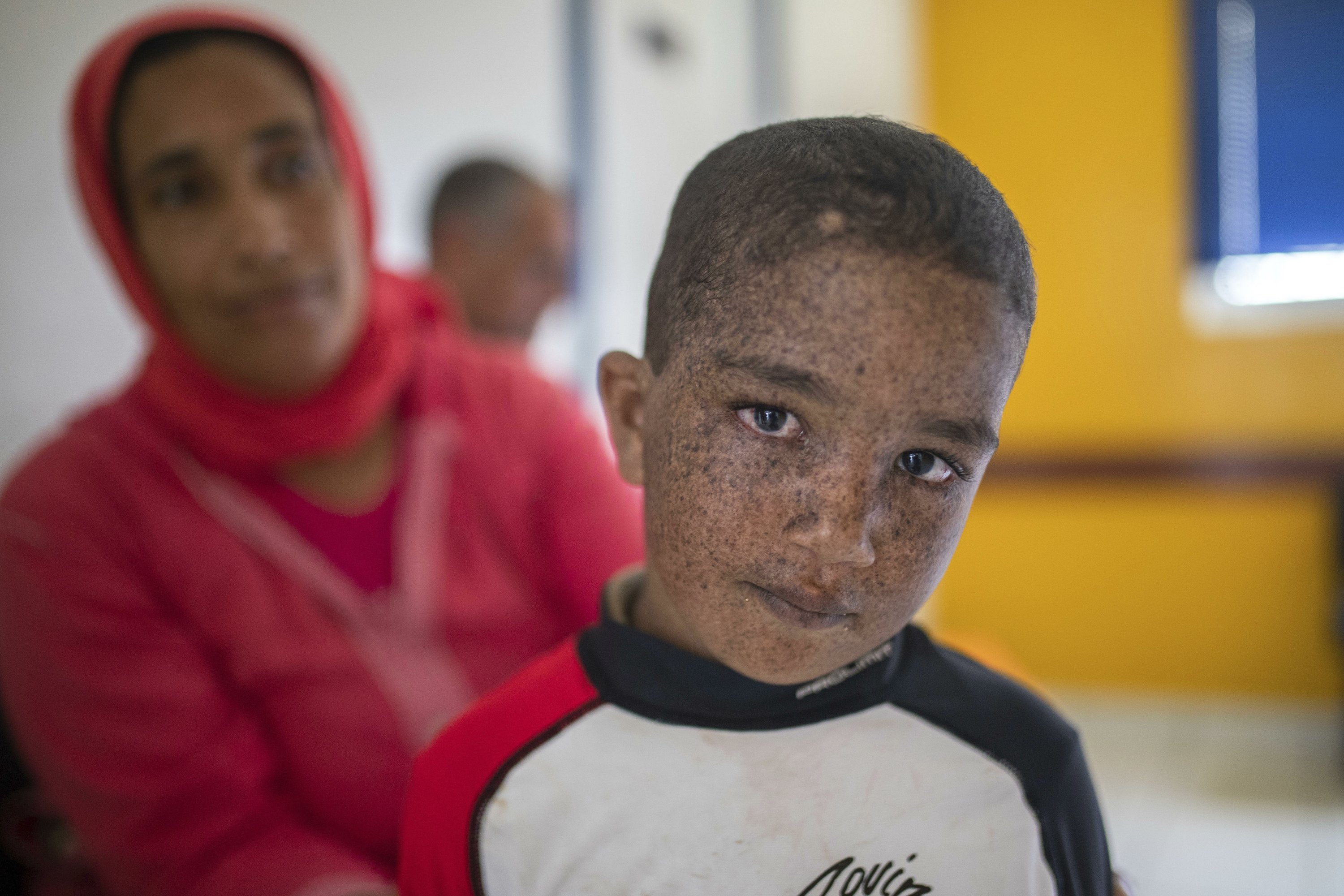 When light is lethal: Moroccans struggle with skin disorder When light is lethal: Moroccans struggle with skin disorder