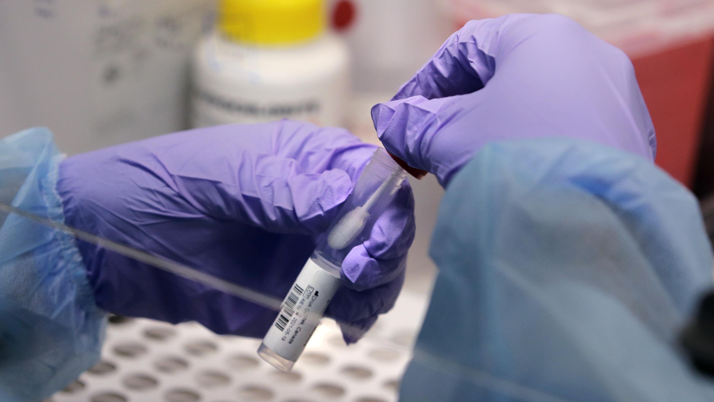 US tracking of virus variants has improved after slow start - Associated Press