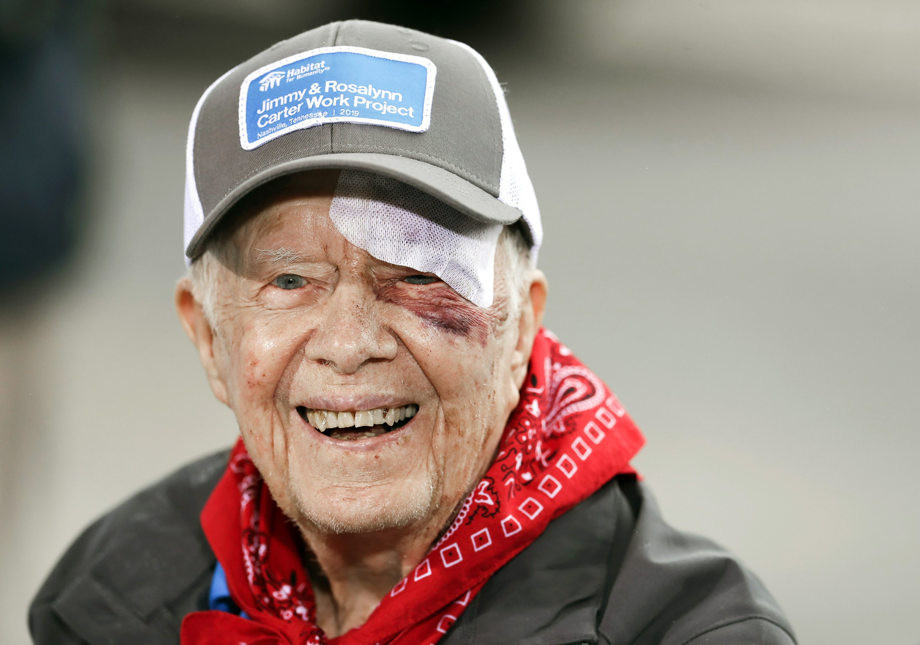 Jimmy Carter hospitalized after fall at home