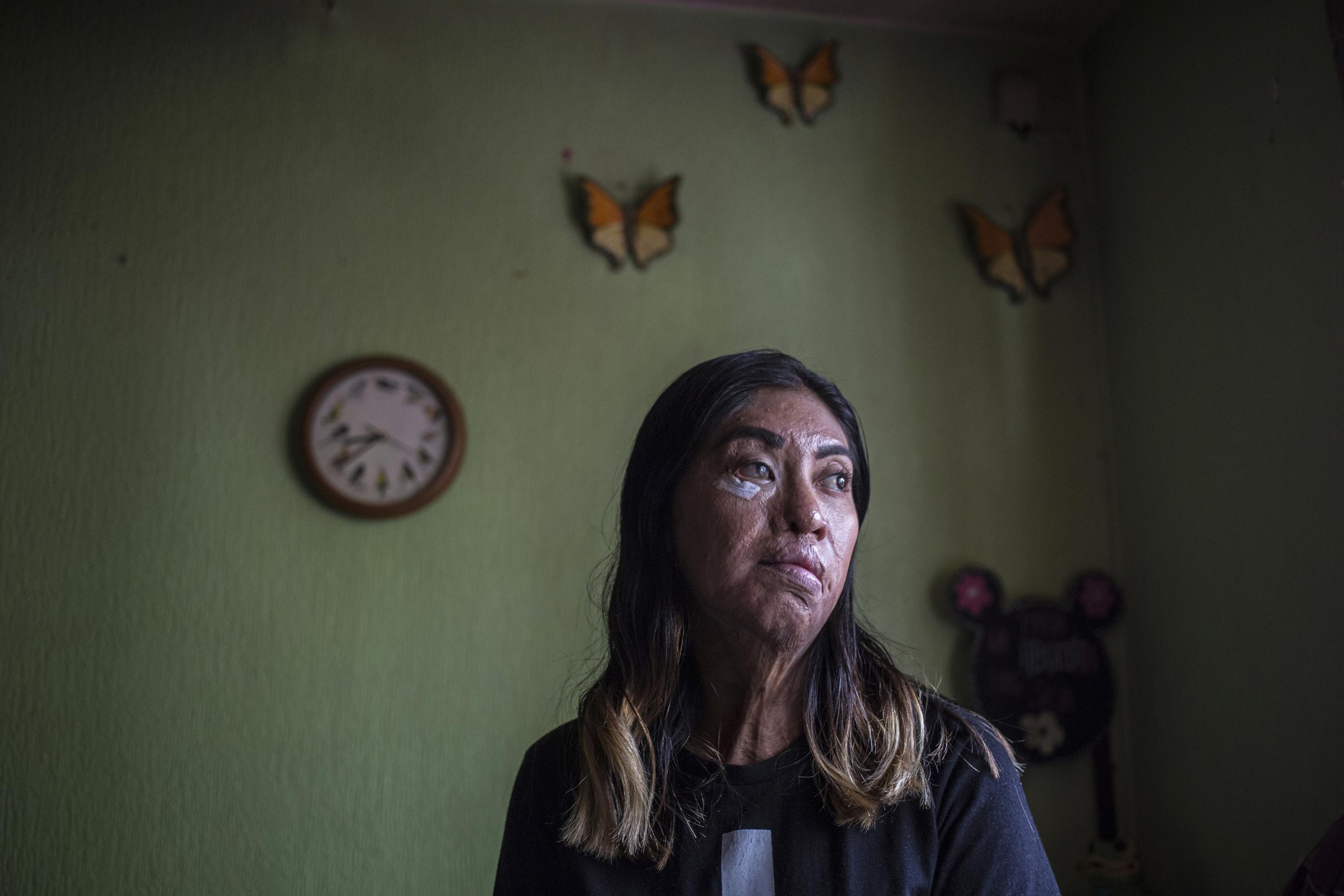 From Mexico To The World: Irlanda Sanchez'S Inspiring Story - fitedim