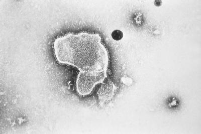 ARCHIVO - Esta foto de 1981 proporcionada por los Centros para el Control y la Prevención de Enfermedades (CDC) muestra una micrografía electrónica del virus sincitial respiratorio, también conocido como RSV. Una nueva investigación anunciada por Pfizer el martes 1 de noviembre de 2022 mostró que vacunar a las mujeres embarazadas ayudó a proteger a sus recién nacidos del virus respiratorio común pero aterrador que llena los hospitales con bebés sibilantes cada otoño. (CDC vía AP, archivo)
