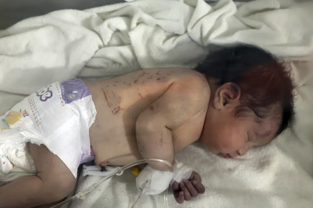 Una beba que nació bajo los escombros provocados por un terremoto en Turquía y Siria recibe tratamiento en una incubadora en el hospital de niños de Afrin, Siria, martes 7 de febrero de 2023. (AP Foto/Ghaith Alsayed)